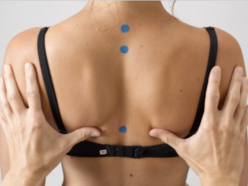 Ruecken einer Frau mit blauen Markierungen wird von zwei Haenden untersucht.